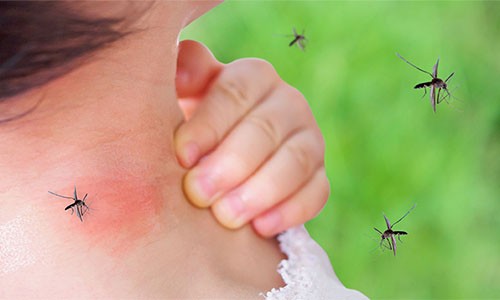 How To Make Mosquito Repellent At Home