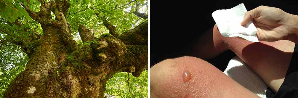 25 Little Known Medicinal Uses for Tree Bark - Beech