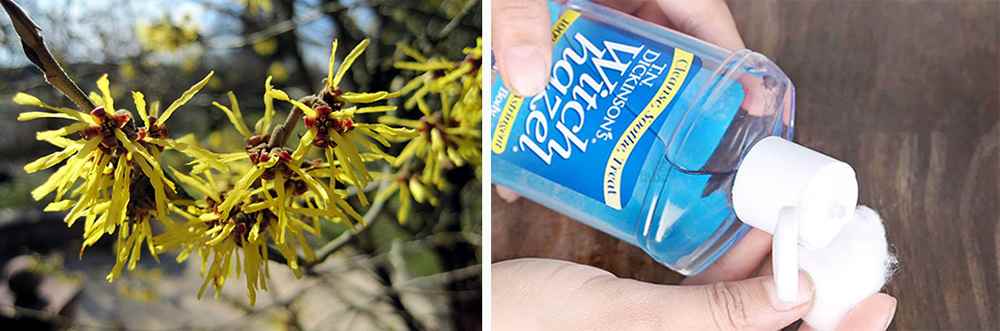 How to Make Your Own Natural First Aid Kit - Witch Hazel