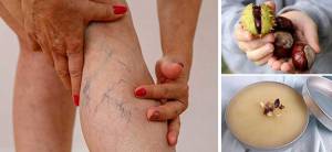 How to Treat Varicose Veins with Chestnuts - Cover Template