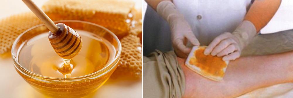 50 Amazing Uses For Honey You Didn’t Know About - Wound Infection