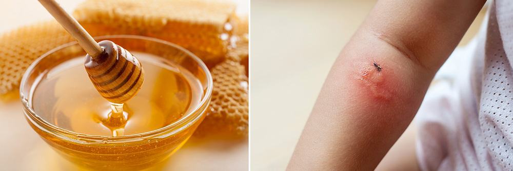 50 Amazing Uses For Honey You Didn’t Know About - Bug Bites