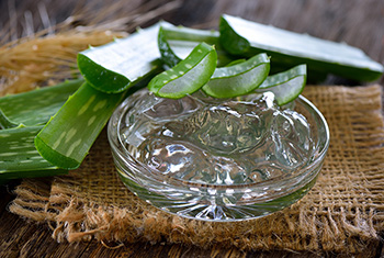 10 Natural Remedies for Toothaches - 9. Aloe Vera