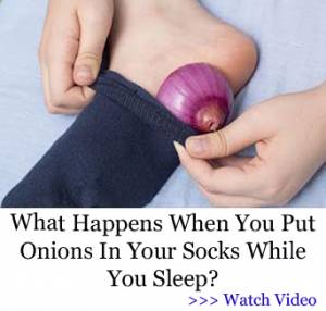 Banner HDG - Onion