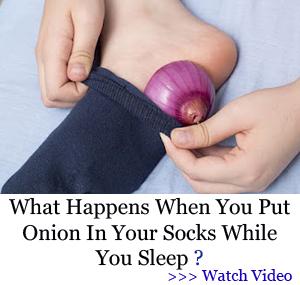 banner HDG - onion sock