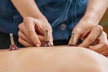 The Legal Narcotic You Can Grow In Your Own Backyard - Mugwort moxibustion