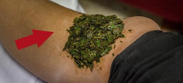 How To Make A Herbal Poultice For Joint Pain