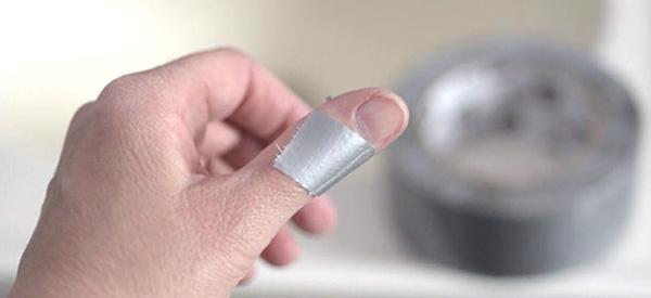How to Get Rid of Warts With Duct Tape