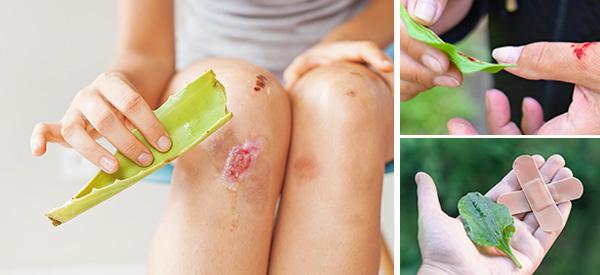 Natural Home Wound Care: Do’s & Don’ts