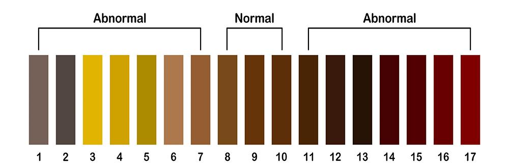 How Healthy Is Your Poop - Color