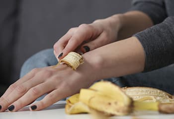 Don’t Throw Banana Peels, Do This Instead!-first aid