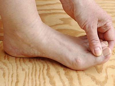 10 Signs Your Feet are Warning You About a Thyroid Problem- Foot Pain