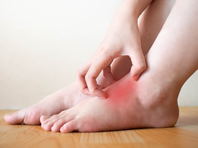 10 Signs Your Feet are Warning You About a Thyroid Problem- Itchy Feet
