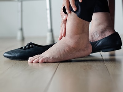 10 Signs Your Feet are Warning You About a Thyroid Problem- Swollen Feet