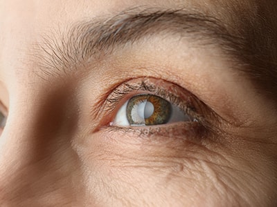 The Truth About Cataracts - cataract