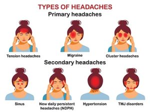 What Headaches Tell You About Your Body - The Lost Herbs