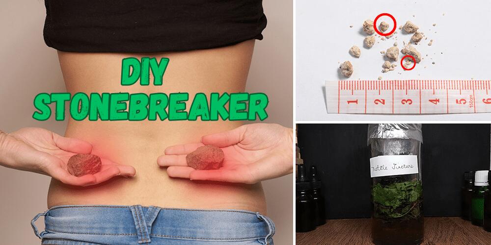 DIY Kidney Stonebreaker Tincture