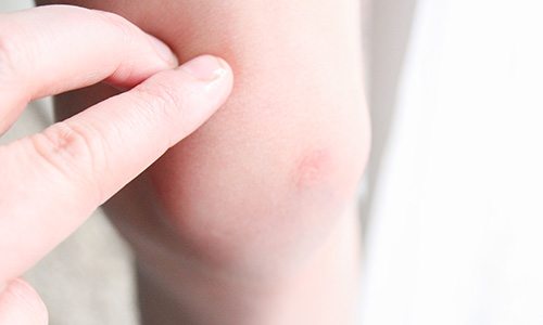 Nature's Advil - how to use