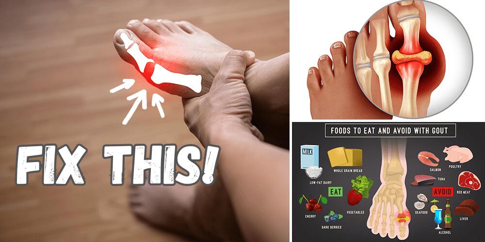 DIY Gout Out Foot Rebuilding Salve