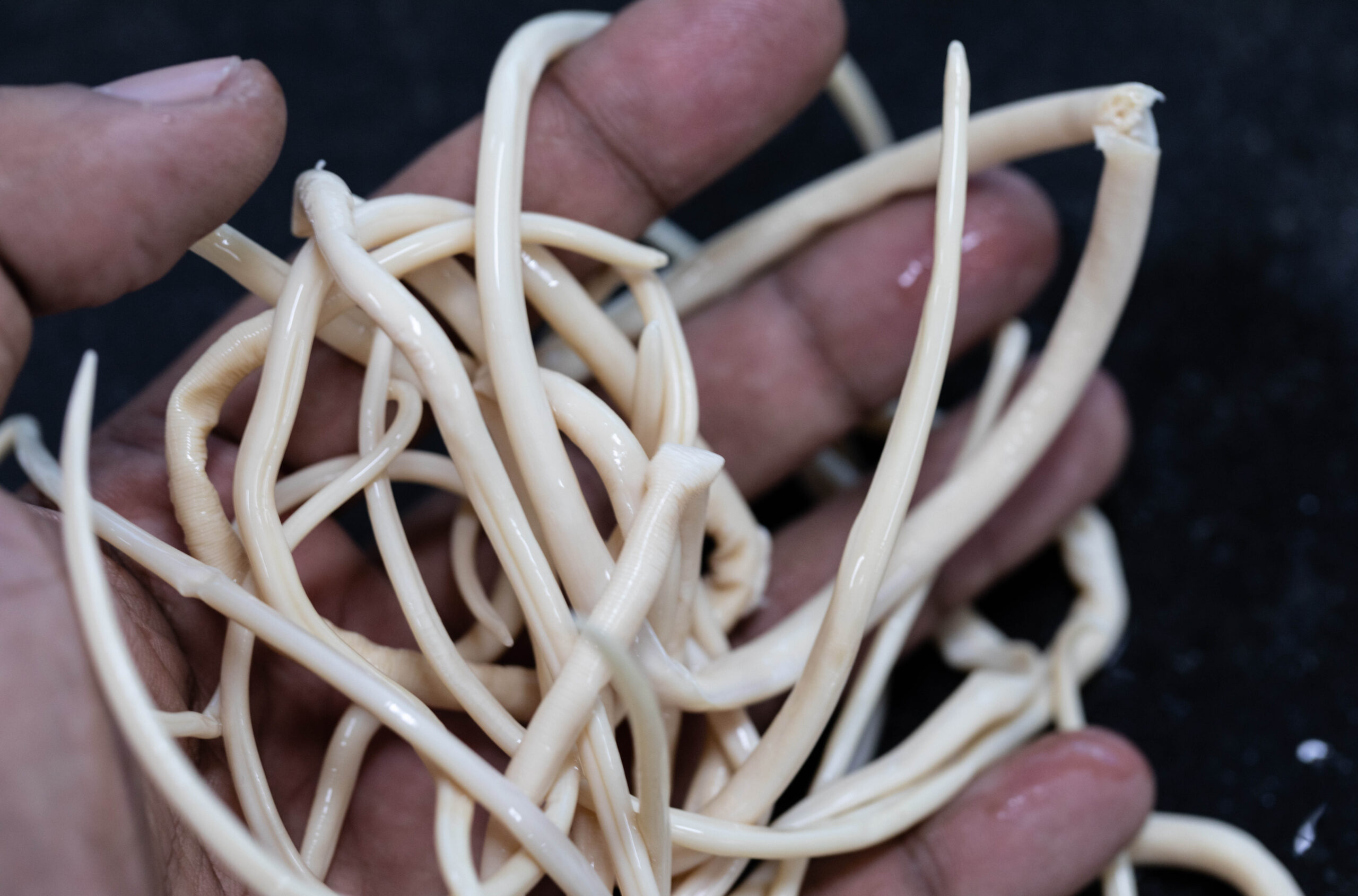 Ascariasis is a disease caused by the parasitic roundworm Ascari