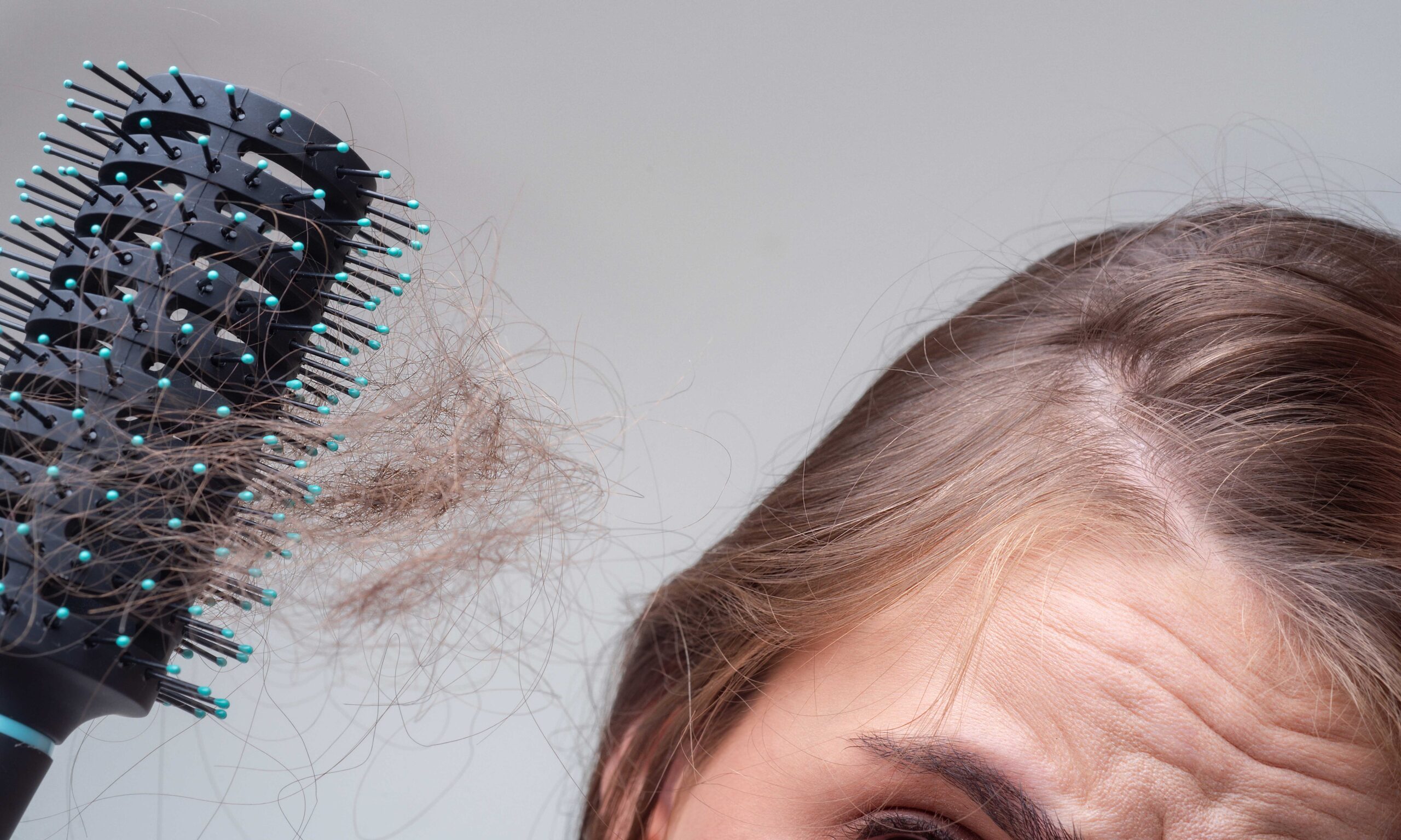 Concept of hair loss. Hair loss close up. tangled Problem hair