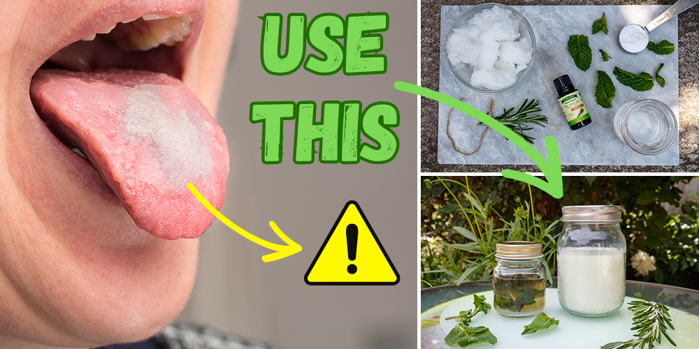 What Your Tongue Says About Your Health