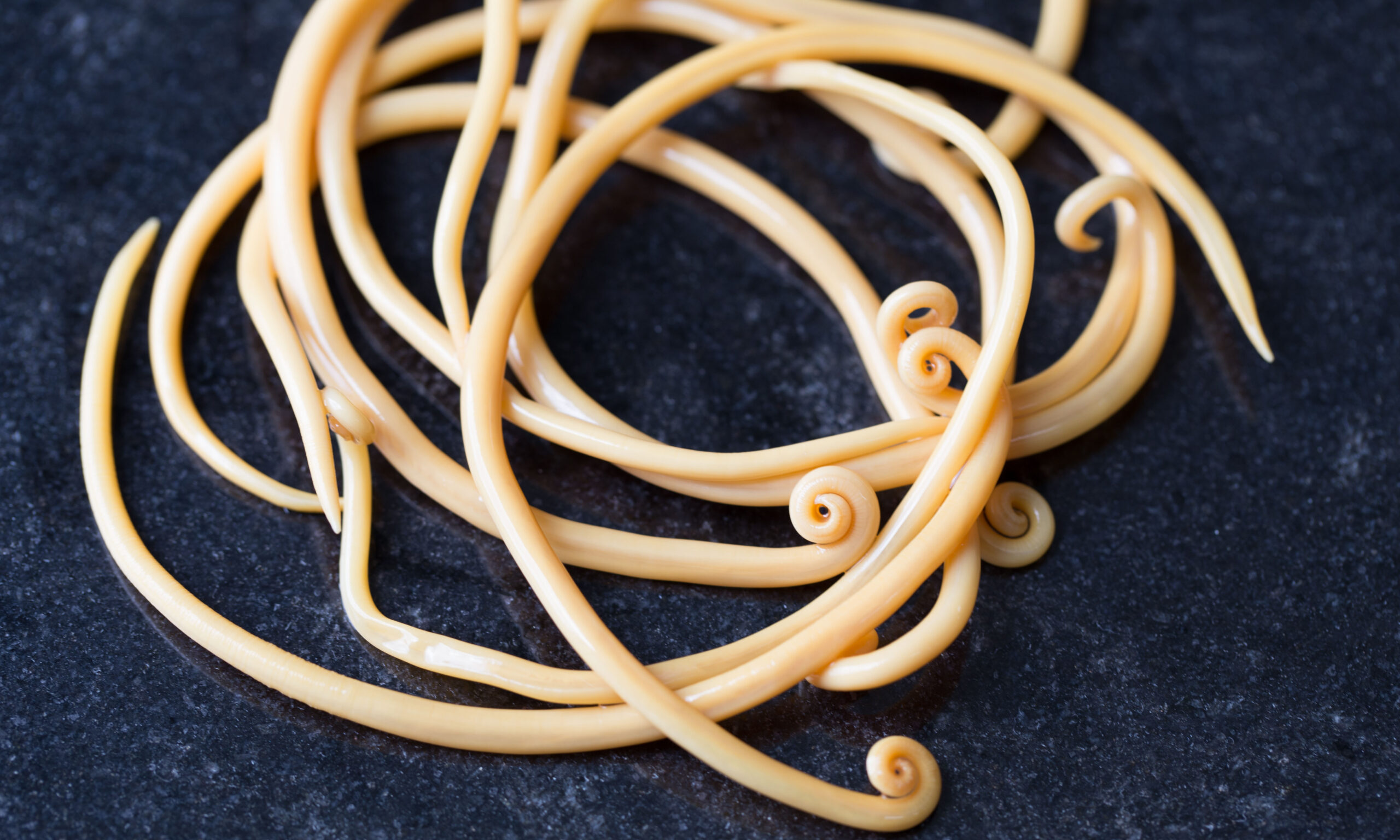 Ascariasis is a disease caused by the parasitic roundworm Ascari