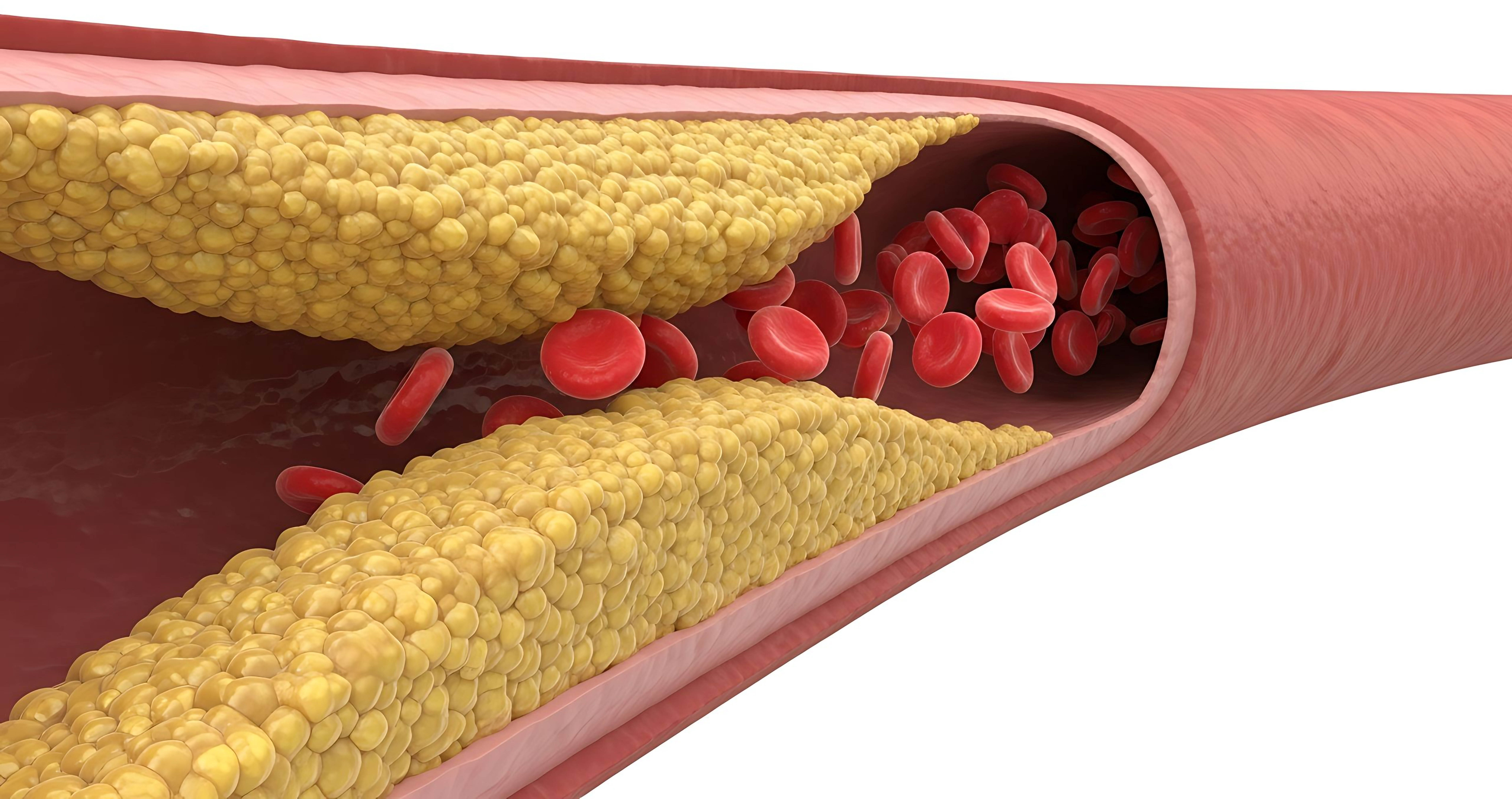 An artistic medical illustration showing the health, with the ar