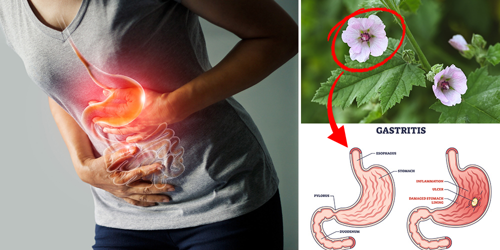 diy gastritis soothing elixir