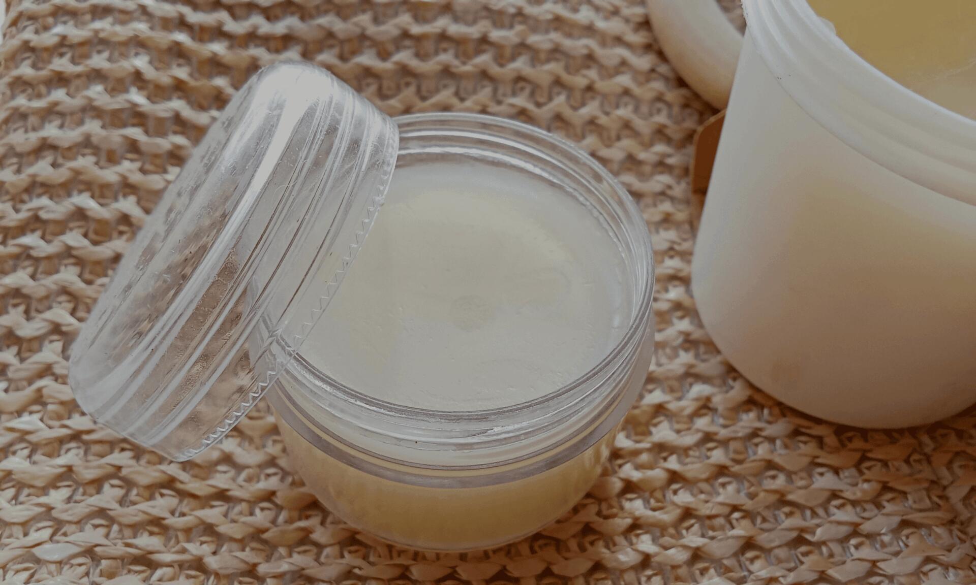 insect bites ready remedy