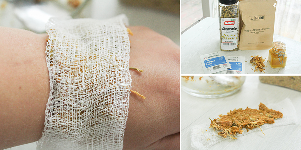 Herbal-Band-Aid-Featured-Image-