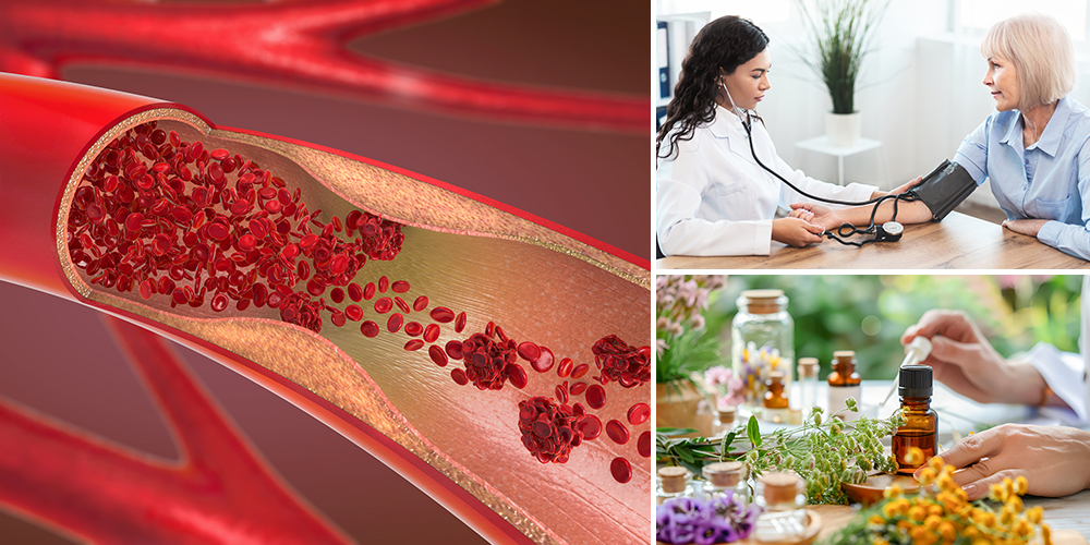 How To Thin Your Blood Naturally