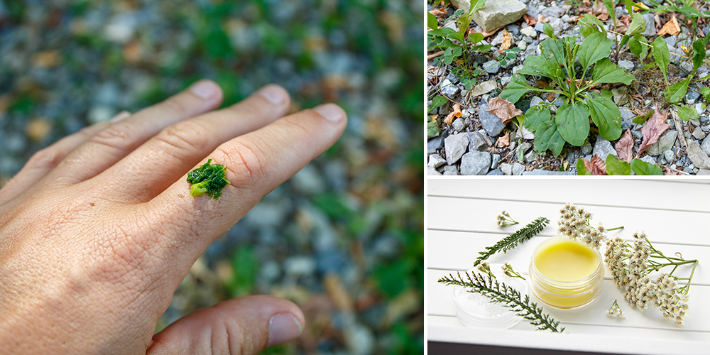 Infections and Wounds