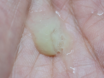 Green mucus on a man hand