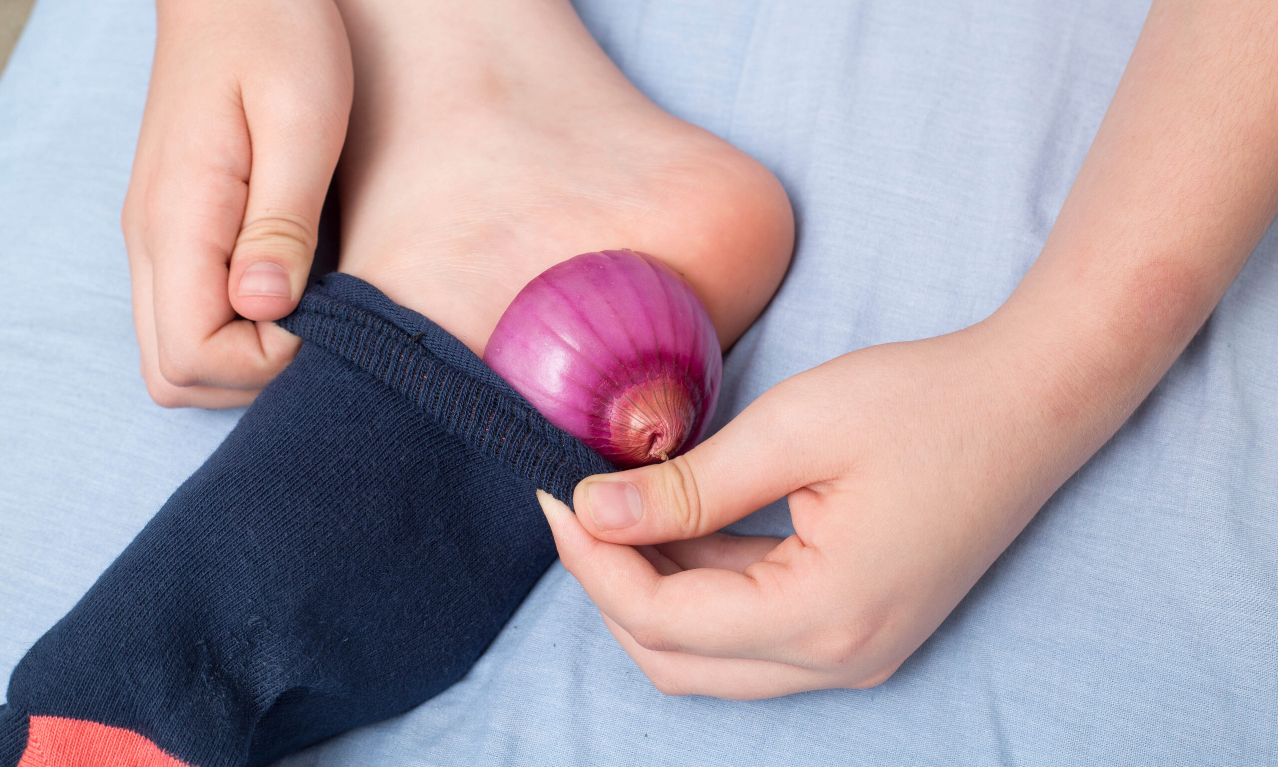 Onion slices in the foot as a medical treatment