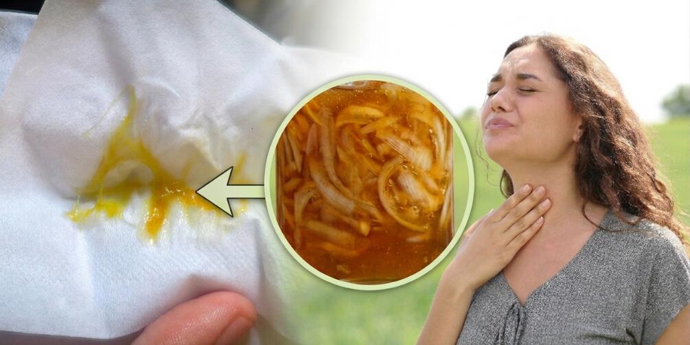 DIY Onion Syrup Mucus Flush cover image
