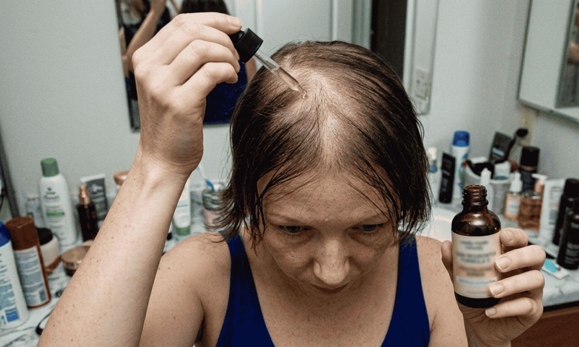 hair loss woman with remedy