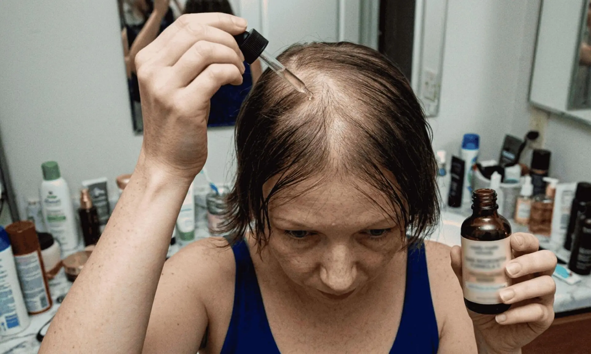 hair loss woman with remedy