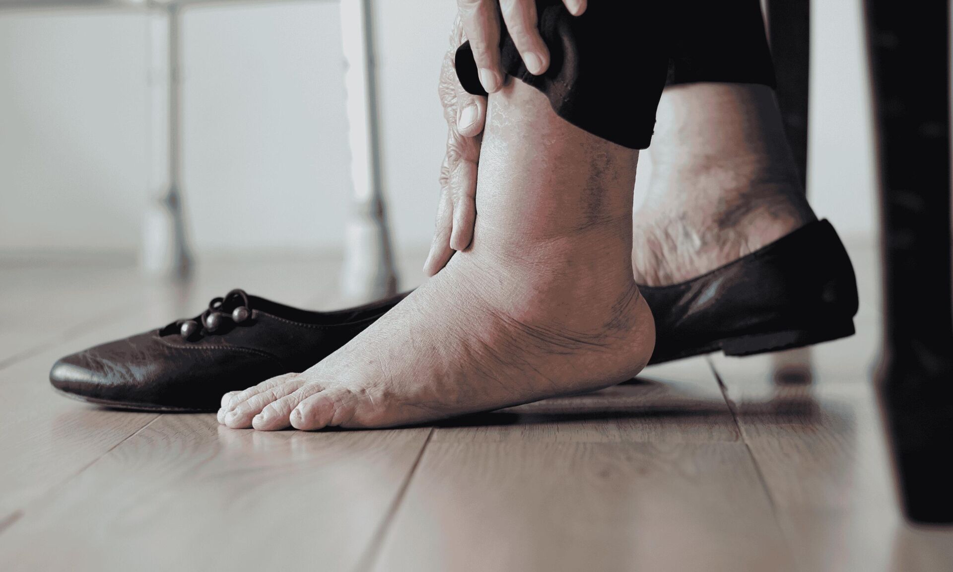 swollen ankles