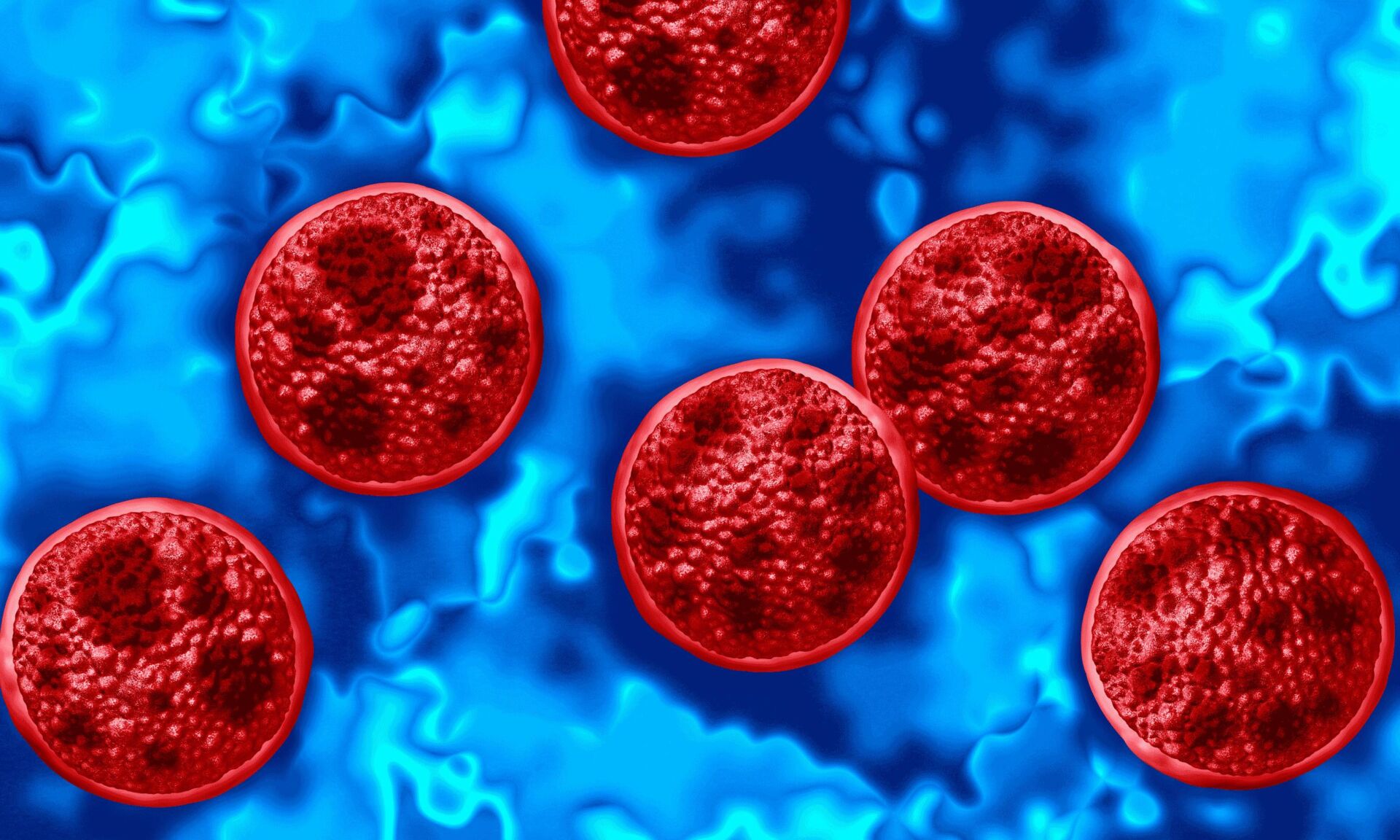 cyclosporiasis