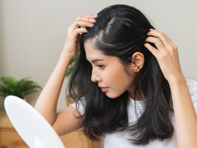 Hair Loss